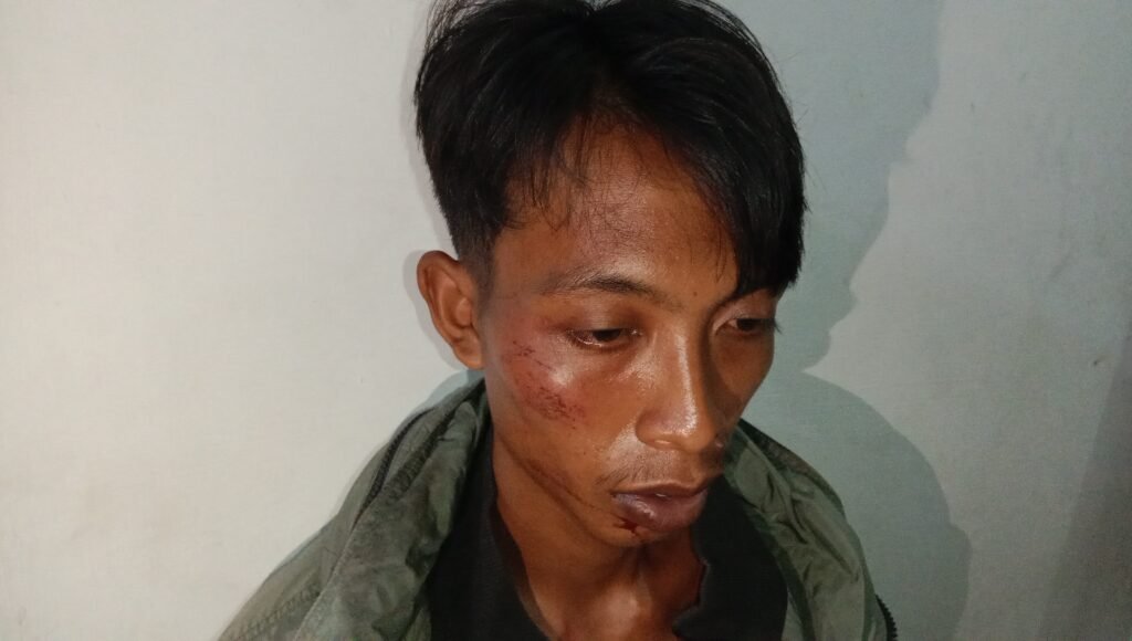 Warga Asahan Mengaku Dianiaya dari Lokasi Perkebunan, Korban Alami Luka Dibagian Wajah