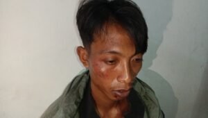 Warga Asahan Mengaku Dianiaya dari Lokasi Perkebunan, Korban Alami Luka Dibagian Wajah