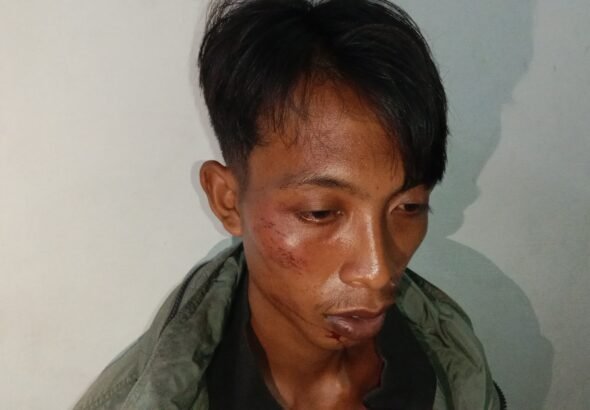 Warga Asahan Mengaku Dianiaya dari Lokasi Perkebunan, Korban Alami Luka Dibagian Wajah